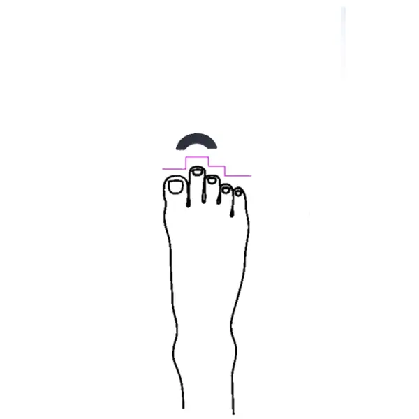 Gel arch for ballet pointe shoes for a shorter big thumb